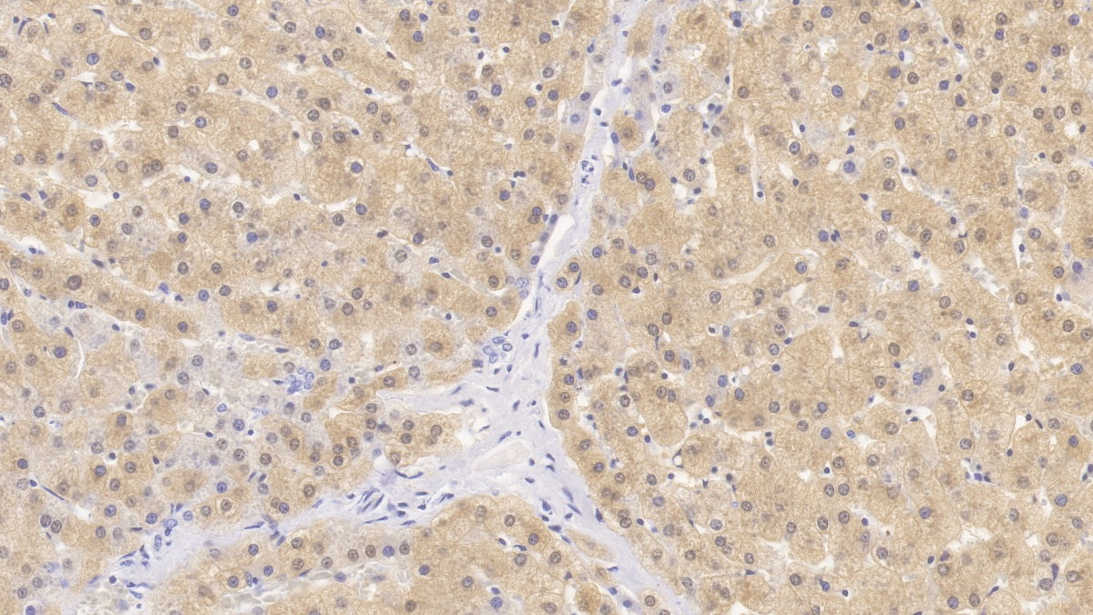 DAB staining on IHC-P; Sample: Human Liver Tissue; Primary Ab: 30ug/ml Mouse Anti-Human HPD Antibody; Control: Used PBS instead of primary antibody; Second Ab: 2ug/ml HRP-Linked Caprine Anti-Mouse IgG Polyclonal Antibody