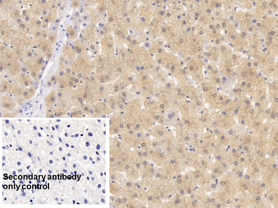 DAB staining on IHC-P; Sample: Human Kidney Tissue; Primary Ab: 30ug/ml Mouse Anti-Human HPD Antibody; Control: Used PBS instead of primary antibody; Second Ab: 2ug/ml HRP-Linked Caprine Anti-Mouse IgG Polyclonal Antibody