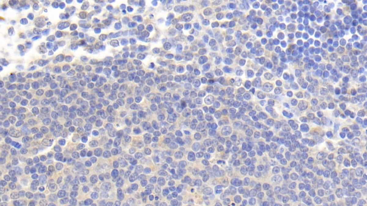 Interleukin 4 Induced Protein 1 (IL4I1) Monoclonal Antibody - image 2