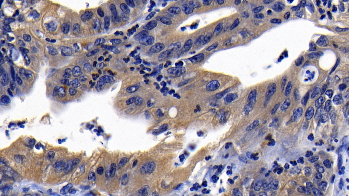 Western Blot; Sample: Lane1: TF1 cell lysate; Lane2: K562 cell lysate Primary Ab: 0.8ug/ml Rabbit Anti-Human PTPN1 Antibody Second Ab: 0.2ug/mL HRP-Linked Caprine Anti-Rabbit IgG Polyclonal Antibody