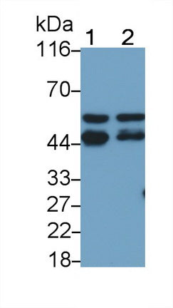 Protein Tyrosine Phosphatase, Non Receptor Type 1 (PTPN1) Polyclonal Antibody - image 5