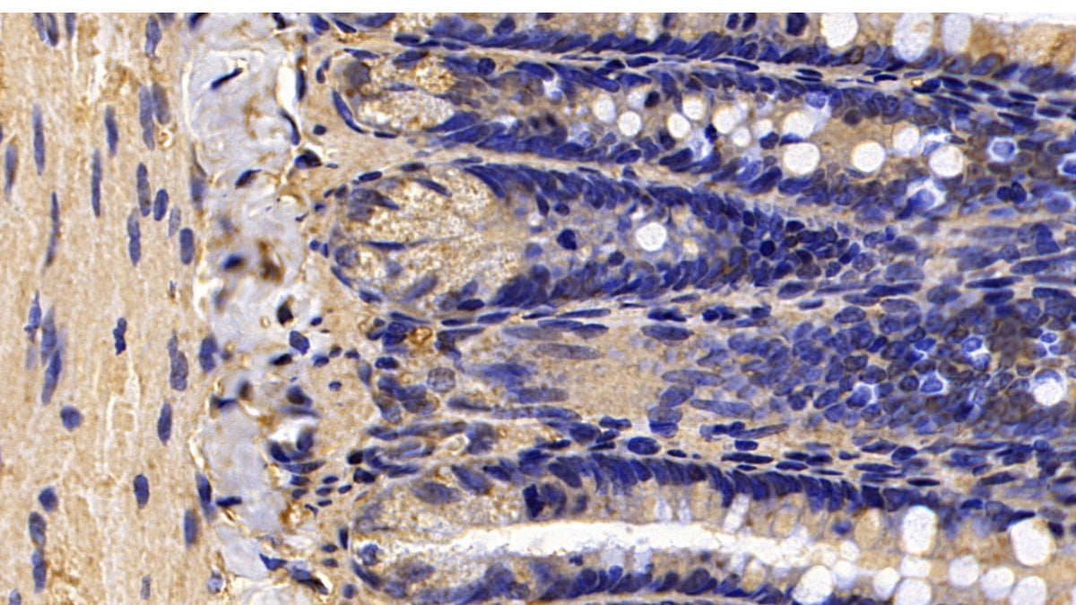 DAB staining on IHC-P; Sample: Rat Small intestine Tissue; Primary Ab: 30ug/ml Mouse Anti-Rat CALR Antibody; Second Ab: 2ug/mL HRP-Linked Caprine Anti-Mouse IgG Polyclonal Antibody