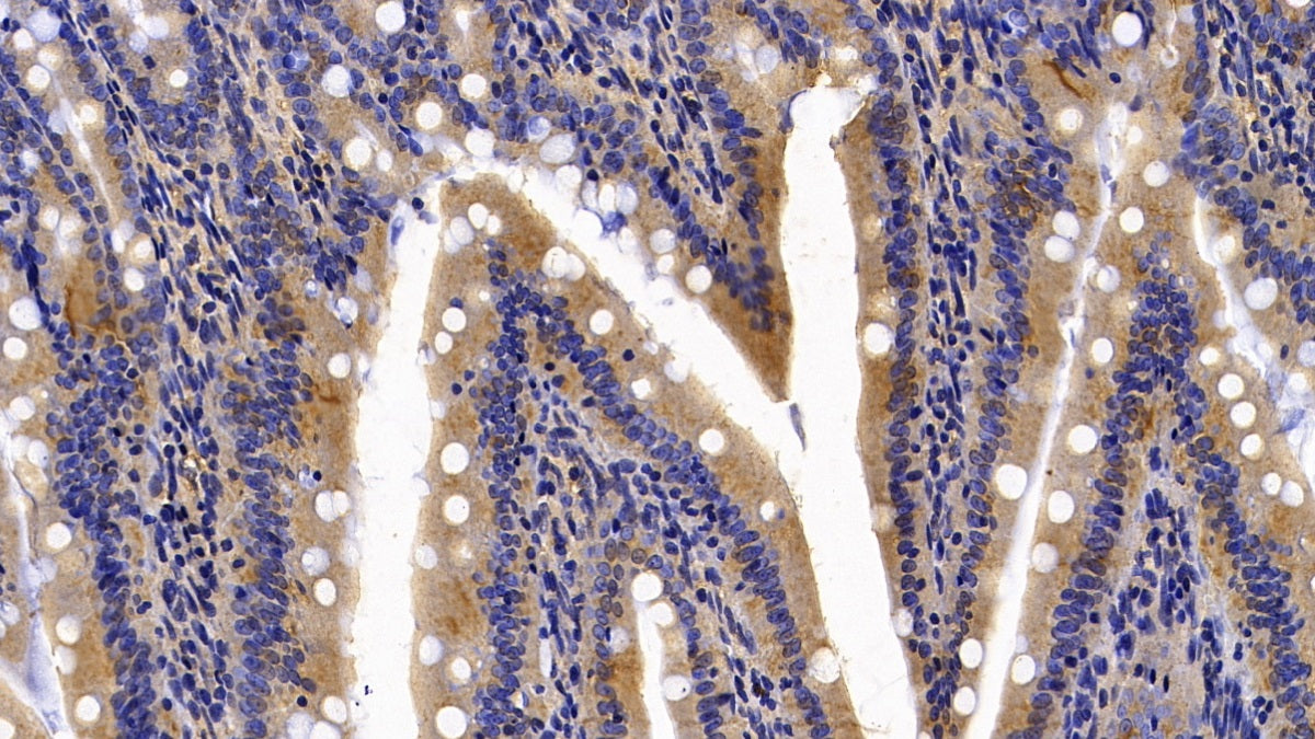 DAB staining on IHC-P; Sample: Rat Cardiac Muscle Tissue; Primary Ab: 30ug/ml Mouse Anti-Rat CALR Antibody; Second Ab: 2ug/mL HRP-Linked Caprine Anti-Mouse IgG Polyclonal Antibody