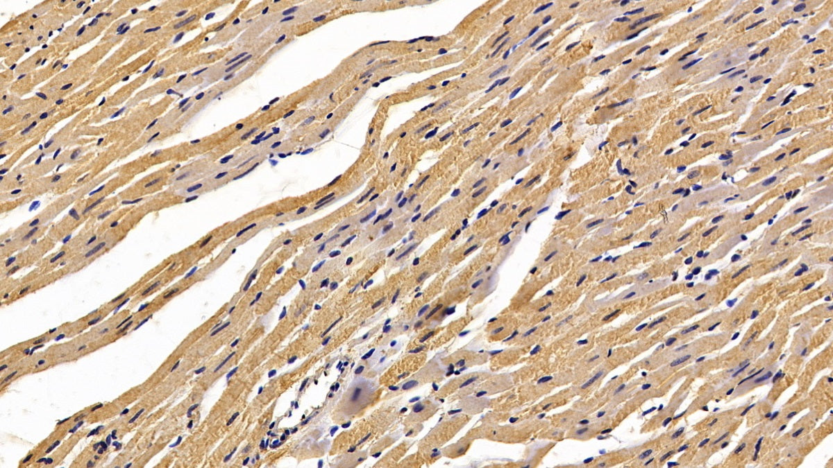DAB staining on IHC-P; Sample: Rat Testis Tissue; Primary Ab: 30ug/ml Mouse Anti-Rat CALR Antibody; Second Ab: 2ug/mL HRP-Linked Caprine Anti-Mouse IgG Polyclonal Antibody