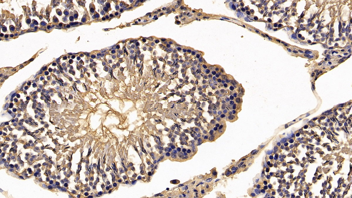 Calreticulin (CALR) Monoclonal Antibody - image 5
