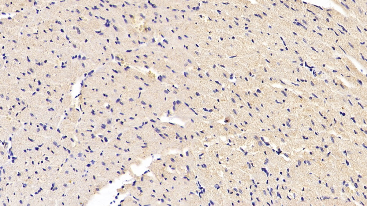 DAB staining on IHC-P; Sample: Rat Cardiac Muscle Tissue; Primary Ab: 30ug/ml Mouse Anti-Rat SOD1 Antibody; Control: Used PBS instead of primary antibody; Second Ab: 2ug/ml HRP-Linked Caprine Anti-Mouse IgG Polyclonal Antibody