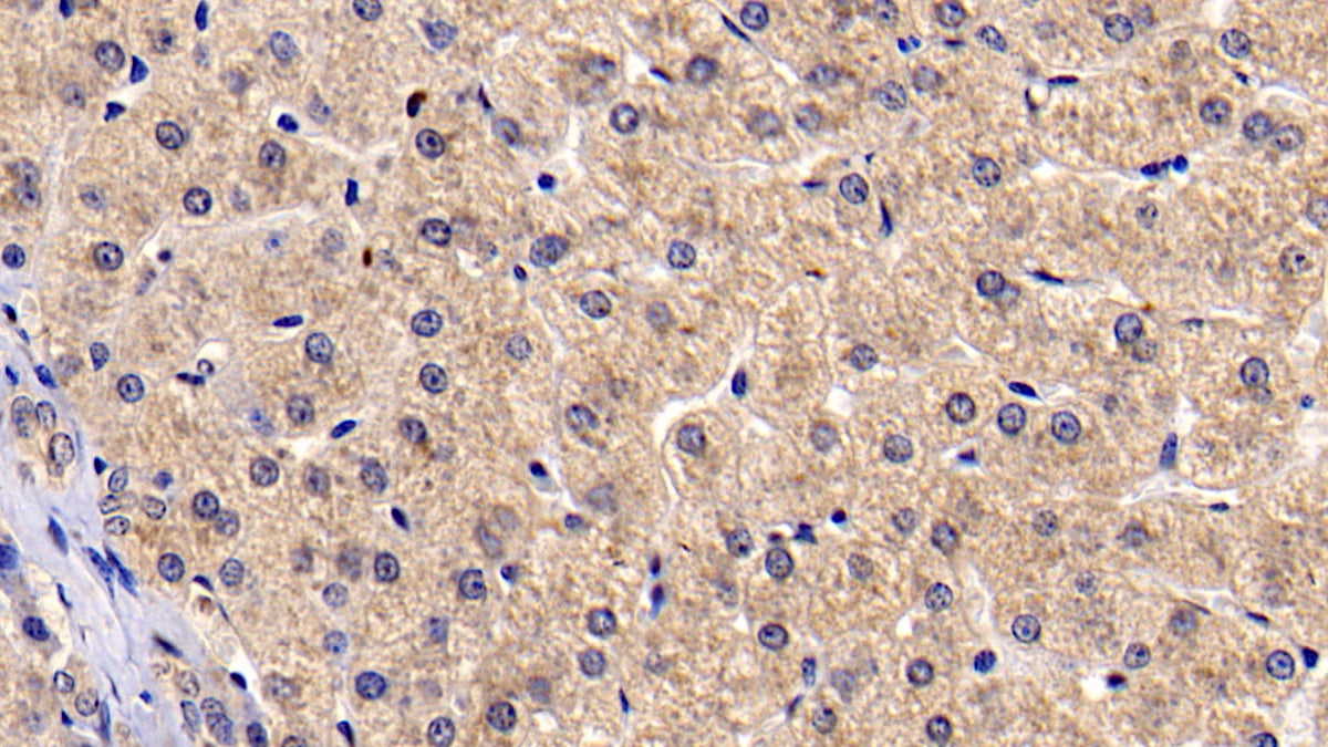 DAB staining on IHC-P; Sample: Human Cardiac Muscle Tissue; Primary Ab: 30ug/ml Mouse Anti-Human BAI3 Antibody; Second Ab: 2ug/mL HRP-Linked Caprine Anti-Mouse IgG Polyclonal Antibody