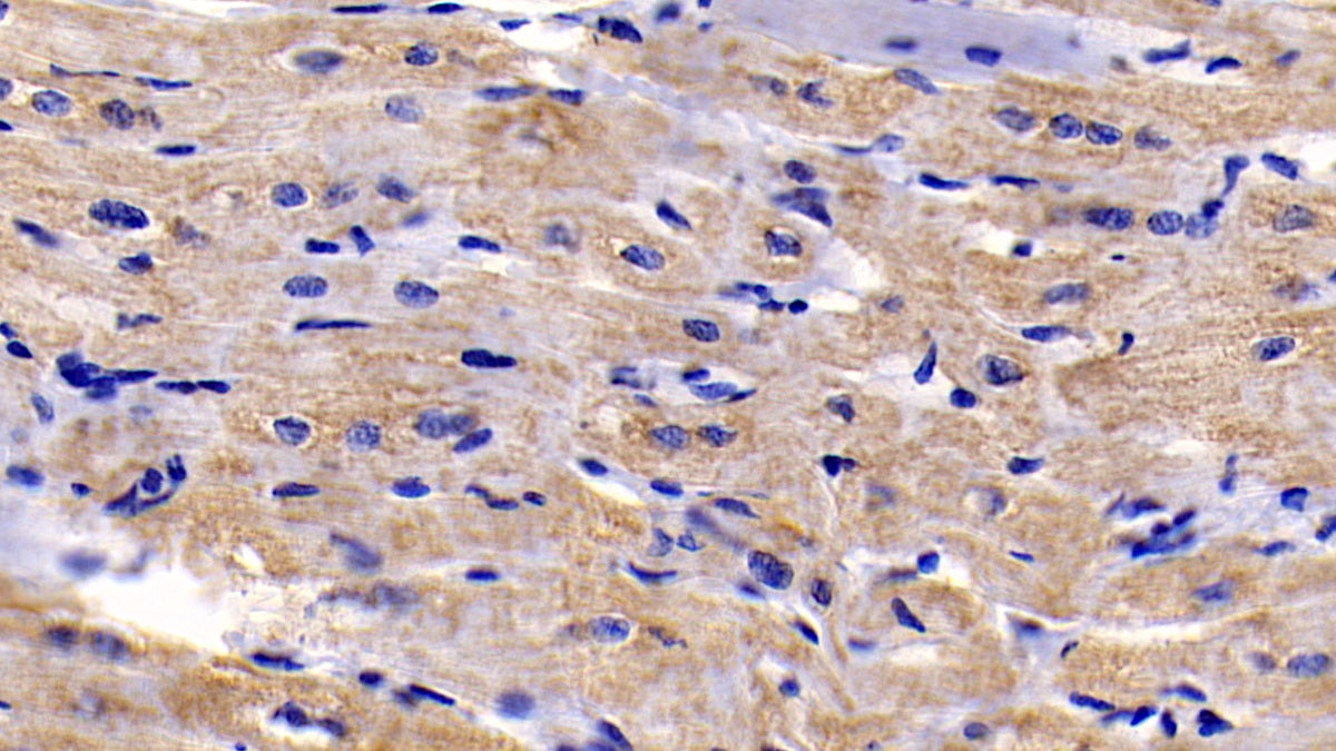 DAB staining on IHC-P; Sample: Human Cerebrum Tissue; Primary Ab: 30ug/ml Mouse Anti-Human BAI3 Antibody; Second Ab: 2ug/mL HRP-Linked Caprine Anti-Mouse IgG Polyclonal Antibody
