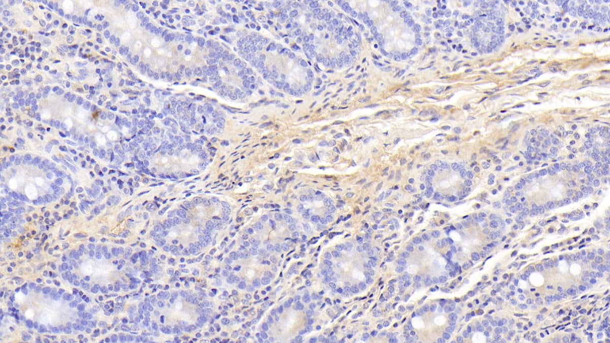 DAB staining on IHC-P; Sample: Human Kidney Tissue; Primary Ab: 20ug/ml Rabbit Anti-Human HJV Antibody; Second Ab: 2ug/mL HRP-Linked Caprine Anti-Rabbit IgG Polyclonal Antibody