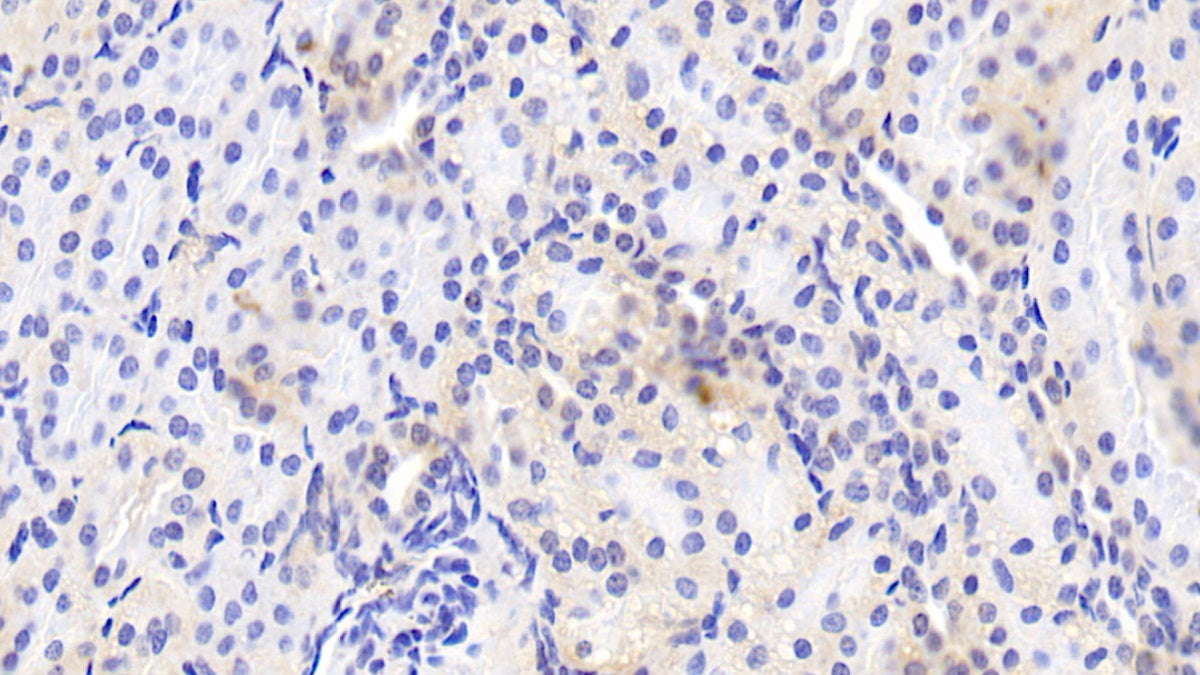 AF488 staining on IF; Sample: K562 cell; Primary Ab: 20ug/ml Rabbit Anti-Human HJV Antibody; Second Ab: 2ug/ml AF488-Linked Caprine Anti-Rabbit IgG Polyclonal Antibody