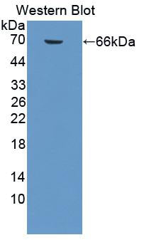 Hemojuvelin (HJV) Polyclonal Antibody - image 5