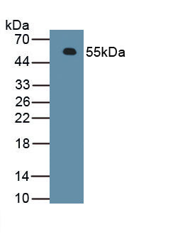 Fragile X Mental Retardation Syndrome Related Protein 1 (FXR1) Polyclonal Antibody - image 2