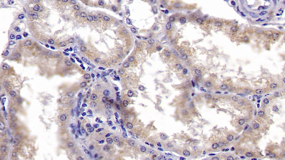 Metallothionein 3 (MT3) Polyclonal Antibody - image 2