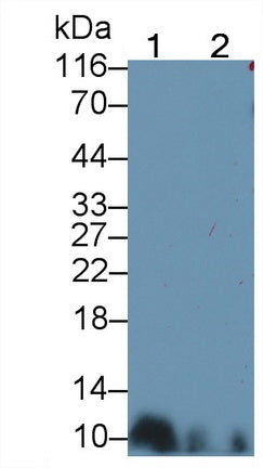 S100 Calcium Binding Protein B (S100B) Monoclonal Antibody - image 2