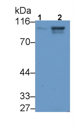 Advillin (AVIL) Polyclonal Antibody - image 2