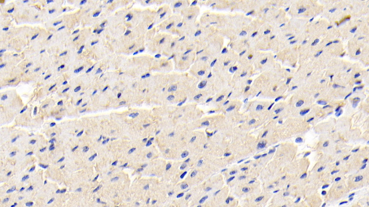 DAB staining on IHC-P; Sample: Human Kidney Tissue; Primary Ab: 20ug/ml Mouse Anti-Human ADP Antibody; Second Ab: 2ug/mL HRP-Linked Caprine Anti-Mouse IgG Polyclonal Antibody