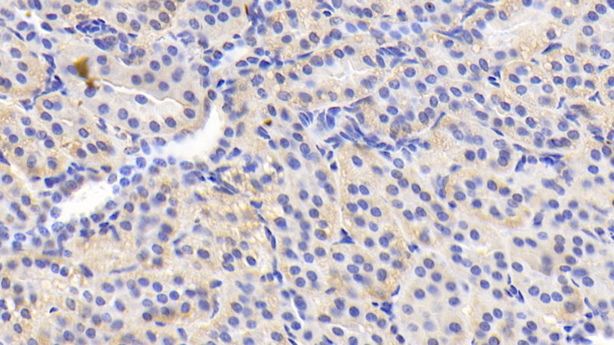 DAB staining on IHC-P; Sample: Human Cardiac Muscle Tissue; Primary Ab: 20ug/ml Mouse Anti-Human ADPN Antibody; Control: Used PBS instead of primary antibody; Second Ab: 2ug/ml HRP-Linked Caprine Anti-Mouse IgG Polyclonal Antibody