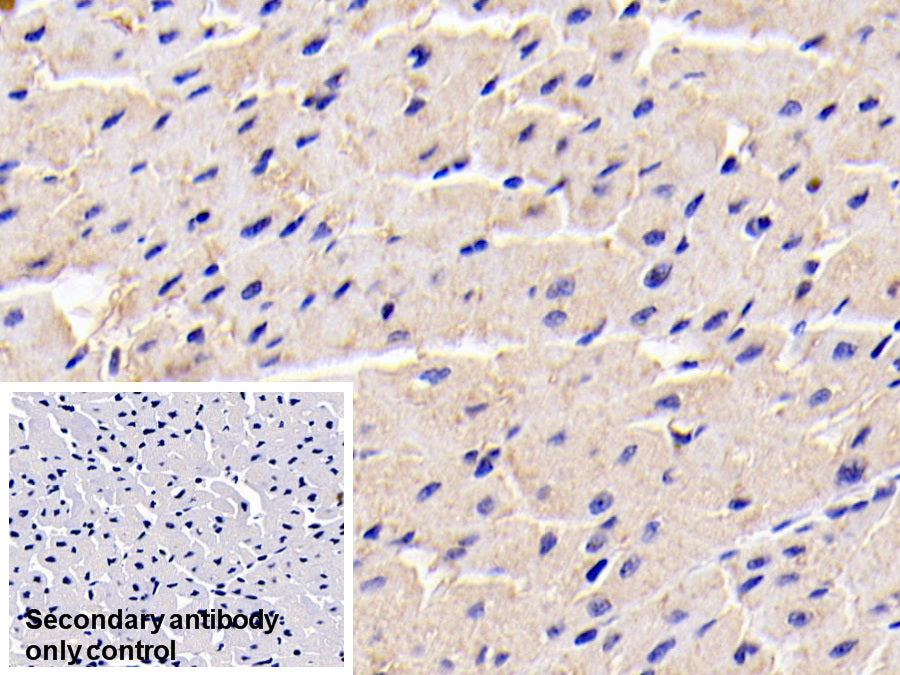 DAB staining on IHC-P; Sample: Human Kidney Tissue; Primary Ab: 20ug/ml Mouse Anti-Human ADPN Antibody; Control: Used PBS instead of primary antibody; Second Ab: 2ug/ml HRP-Linked Caprine Anti-Mouse IgG Polyclonal Antibody