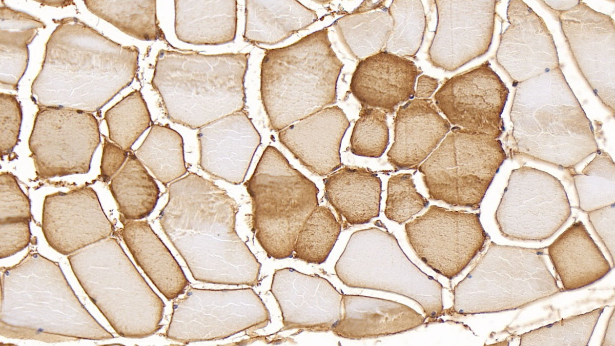 DAB staining on IHC-P; Sample: Human Cardiac Muscle Tissue; Primary Ab: 30ug/ml Mouse Anti-Human MYO Antibody; Second Ab: 2ug/mL HRP-Linked Caprine Anti-Mouse IgG Polyclonal Antibody