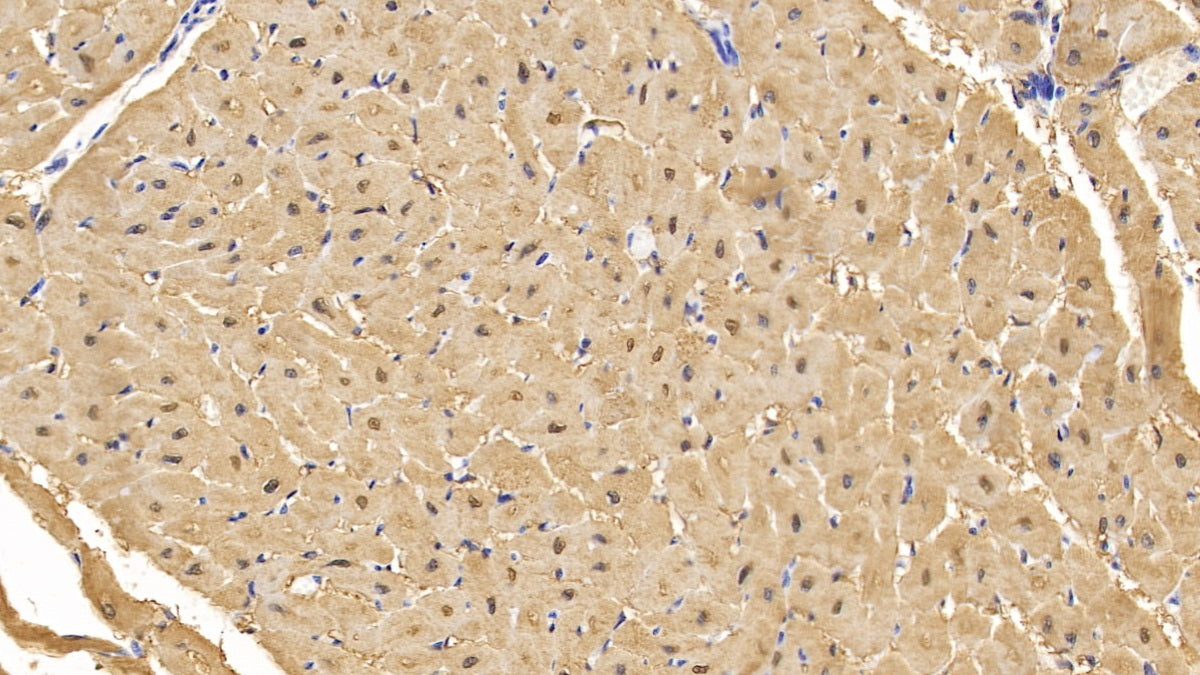 DAB staining on IHC-P; Sample: Human Cardiac Muscle Tissue; Primary Ab: 30ug/ml Mouse Anti-Human MYO Antibody; Control: Used PBS instead of primary antibody; Second Ab: 2ug/ml HRP-Linked Caprine Anti-Mouse IgG Polyclonal Antibody