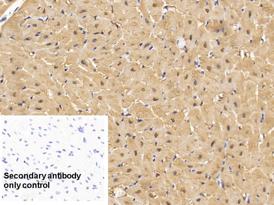 DAB staining on IHC-P; Sample: Human Skeletal muscle Tissue; Primary Ab: 30ug/ml Mouse Anti-Human MYO Antibody; Control: Used PBS instead of primary antibody; Second Ab: 2ug/ml HRP-Linked Caprine Anti-Mouse IgG Polyclonal Antibody
