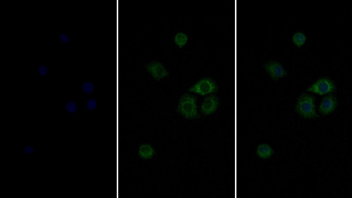 Western Blot; Sample: Lane1: MCF7 cell lysate; Lane2: HepG2 cell lysate; Lane3: A431 cell lysate Primary Ab: 2ug/ml Mouse Anti-Human IFNa/bR1 Antibody Second Ab: 0.2ug/mL HRP-Linked Caprine Anti-Mouse IgG Polyclonal Antibody