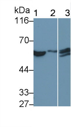 Interferon Alpha/Beta Receptor 1 (IFNa/bR1) Monoclonal Antibody - image 3