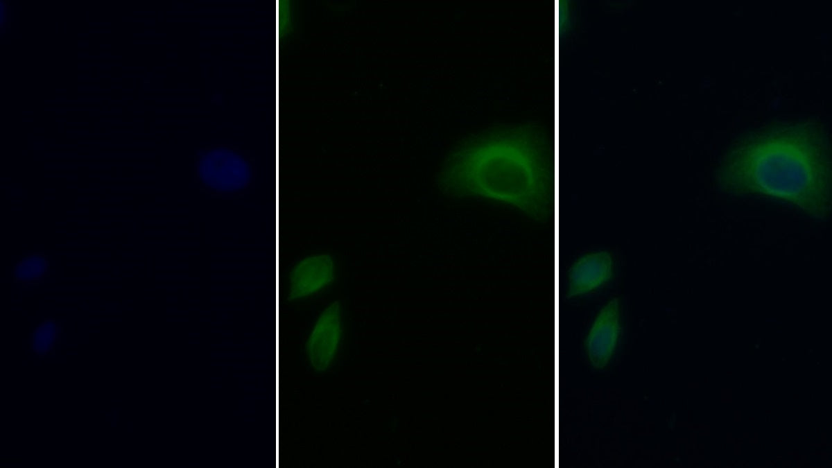 Western Blot; Sample: HepG2 cell lysate Primary Ab: 5ug/ml Mouse Anti-Rat APOB Antibody Second Ab: 0.2ug/mL HRP-Linked Caprine Anti-Mouse IgG Polyclonal Antibody
