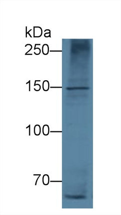 Apolipoprotein B (APOB) Monoclonal Antibody - image 3