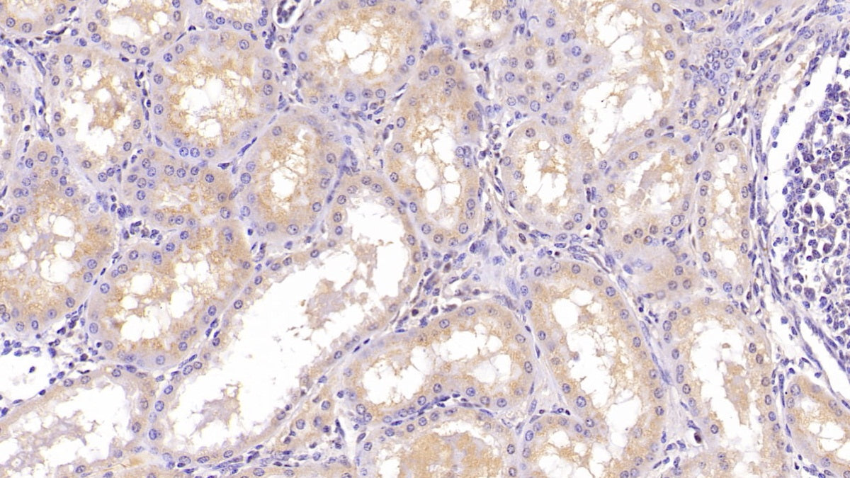 DAB staining on IHC-P; Sample: Porcine Liver Tissue; Primary Ab: 40ug/ml Mouse Anti-Porcine APOA1 Antibody; Second Ab: 2ug/mL HRP-Linked Caprine Anti-Mouse IgG Polyclonal Antibody