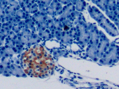 Western Blot; Sample: Lane1: Rat Liver lysate; Lane2: Rat Thyroid lysate; Lane3: HepG2 cell lysate Primary Ab: 3ug/ml Mouse Anti-Rat PTHrP Antibody Second Ab: 0.2ug/mL HRP-Linked Caprine Anti-Mouse IgG Polyclonal Antibody