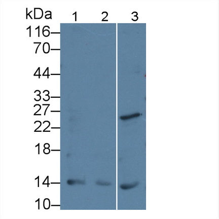 Parathyroid Hormone Related Protein (PTHrP) Monoclonal Antibody - image 3