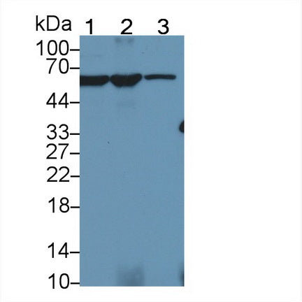 Pyruvate kinase isozymes M2 (PKM2) Polyclonal Antibody - image 2