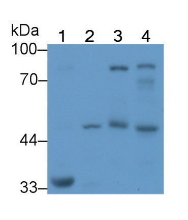 Alpha-1-Antitrypsin (a1AT) Monoclonal Antibody - image 4