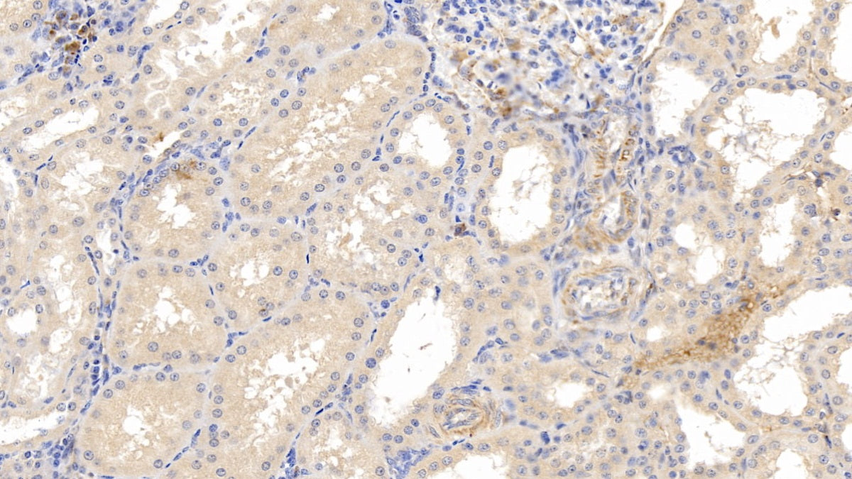 DAB staining on IHC-P; Sample: Human Spleen Tissue; Primary Ab: 20ug/ml Mouse Anti-Human MMP8 Antibody; Second Ab: 2ug/mL HRP-Linked Caprine Anti-Mouse IgG Polyclonal Antibody