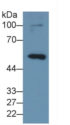 Matrix Metalloproteinase 8 (MMP8) Monoclonal Antibody - image 5