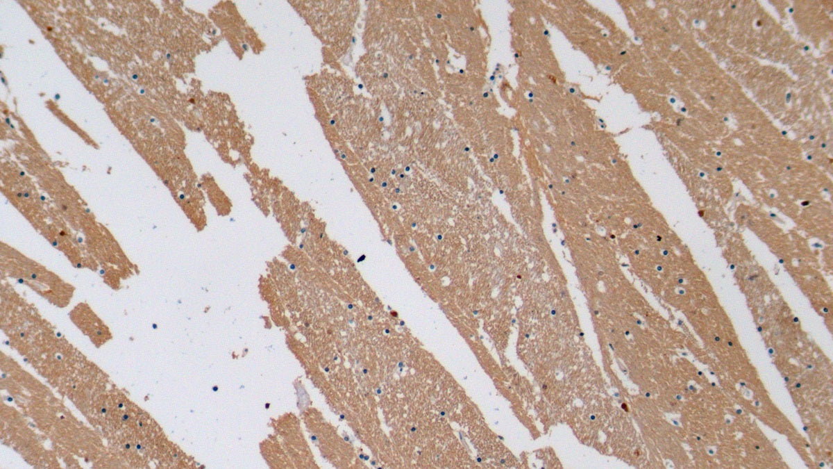 Western Blot; Sample: Lane1: Hela cell lysate; Lane2: Rat Cerebrum lysate; Lane3: Porcine Cerebrum lysate Primary Ab: 2ug/ml Mouse Anti-Human NSE Antibody Second Ab: 0.2ug/mL HRP-Linked Caprine Anti-Mouse IgG Polyclonal Antibody