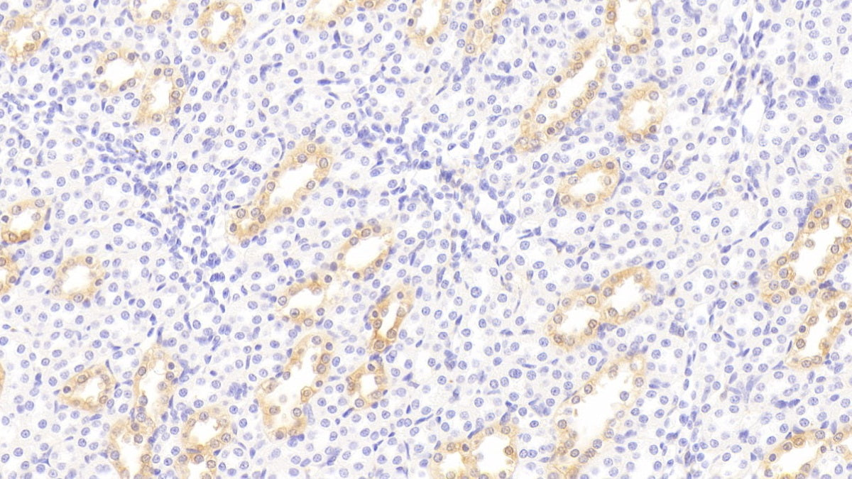 DAB staining on IHC-P; Sample: Rat Uterus Tissue; Primary Ab: 30ug/ml Mouse Anti-Rat GAL3 Antibody; Second Ab: 2ug/mL HRP-Linked Caprine Anti-Mouse IgG Polyclonal Antibody
