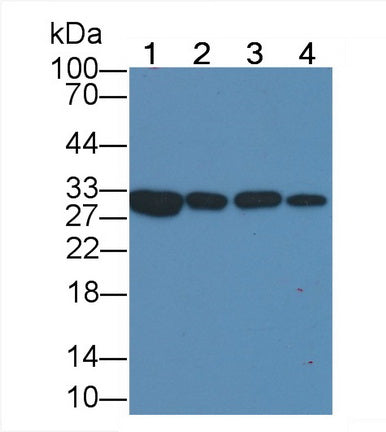 Galectin 3 (GAL3) Monoclonal Antibody - image 4