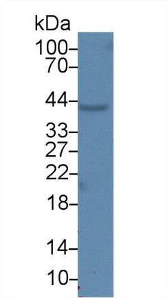 Arginase II (Arg2) Monoclonal Antibody - image 2