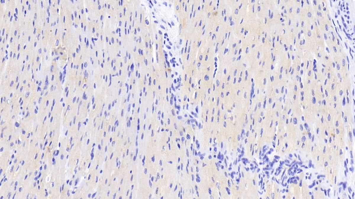 DAB staining on IHC-P; Sample: Human Cardiac Muscle Tissue; Primary Ab: 20ug/ml Mouse Anti-Human ADPN Antibody; Control: Used PBS instead of primary antibody; Second Ab: 2ug/ml HRP-Linked Caprine Anti-Mouse IgG Polyclonal Antibody