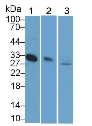 Adiponectin (ADPN) Monoclonal Antibody - image 4