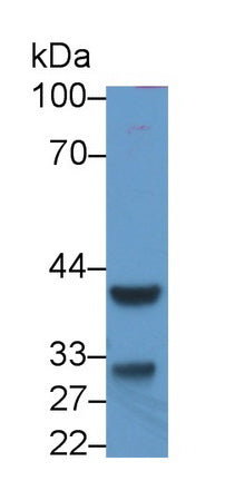 Inhibin Beta C (INHbC) Monoclonal Antibody - image 2