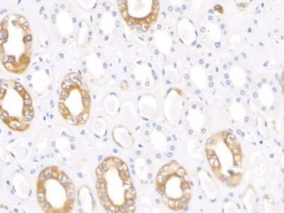 Cytokeratin 17 (CK17) Monoclonal Antibody - image 5