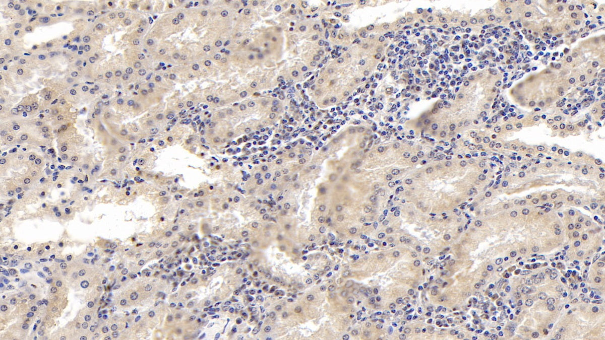 DAB staining on IHC-P; Sample: Porcine Cerebrum Tissue; Primary Ab: 10ug/ml Mouse Anti-Human LCAT Antibody; Second Ab: 2ug/mL HRP-Linked Caprine Anti-Mouse IgG Polyclonal Antibody