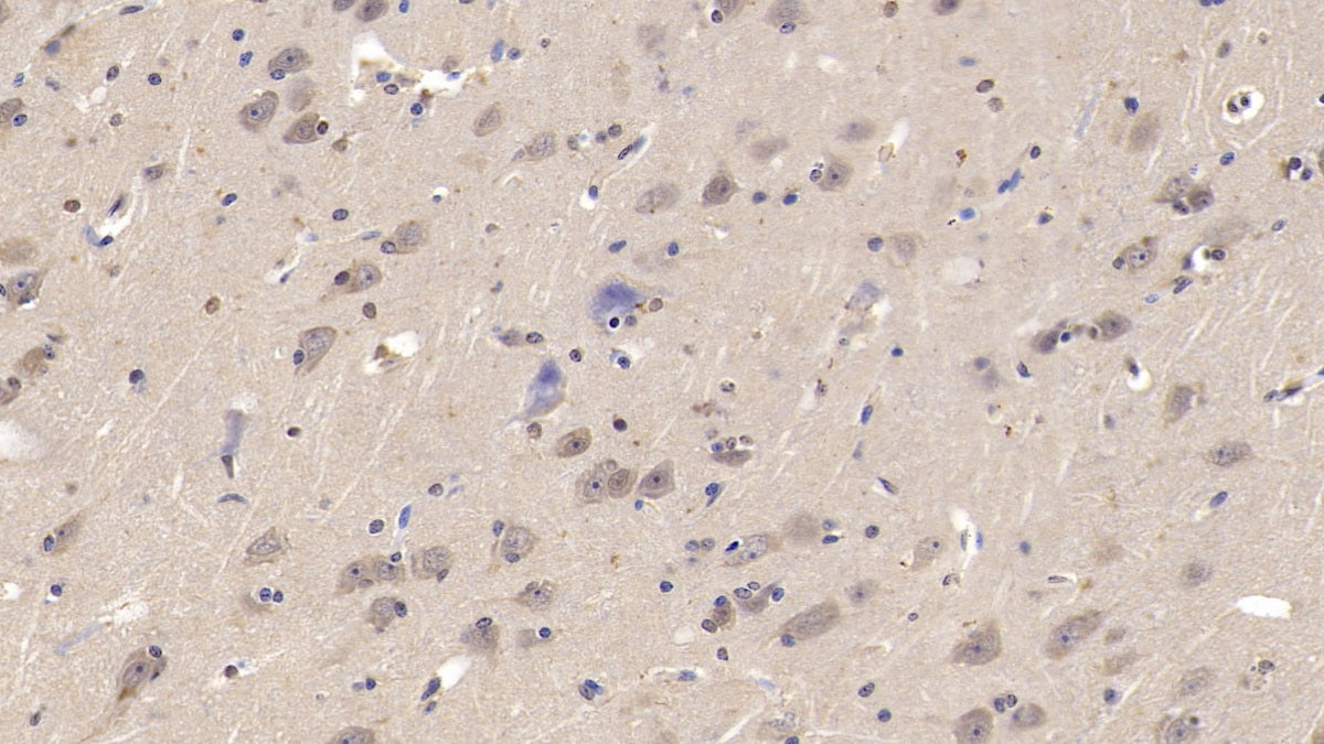 DAB staining on IHC-P; Sample: Porcine Liver Tissue; Primary Ab: 10ug/ml Mouse Anti-Human LCAT Antibody; Second Ab: 2ug/mL HRP-Linked Caprine Anti-Mouse IgG Polyclonal Antibody