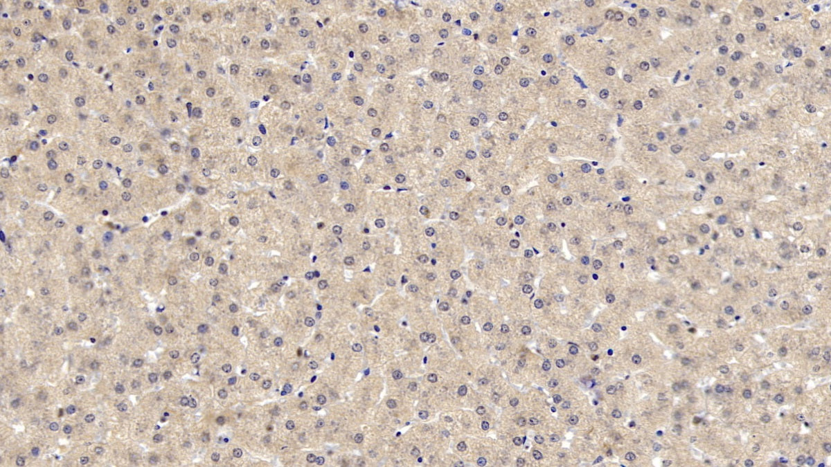 Western Blot; Sample: Lane1: HepG2 cell lysate; Lane2: U2OS cell lysate; Lane3: Hela cell lysate Primary Ab: 1ug/ml Mouse Anti-Human LCAT Antibody Second Ab: 0.2ug/mL HRP-Linked Caprine Anti-Mouse IgG Polyclonal Antibody