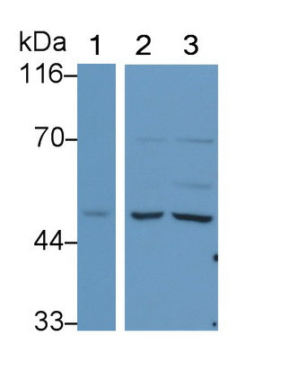 Lecithin Cholesterol Acyltransferase (LCAT) Monoclonal Antibody - image 5