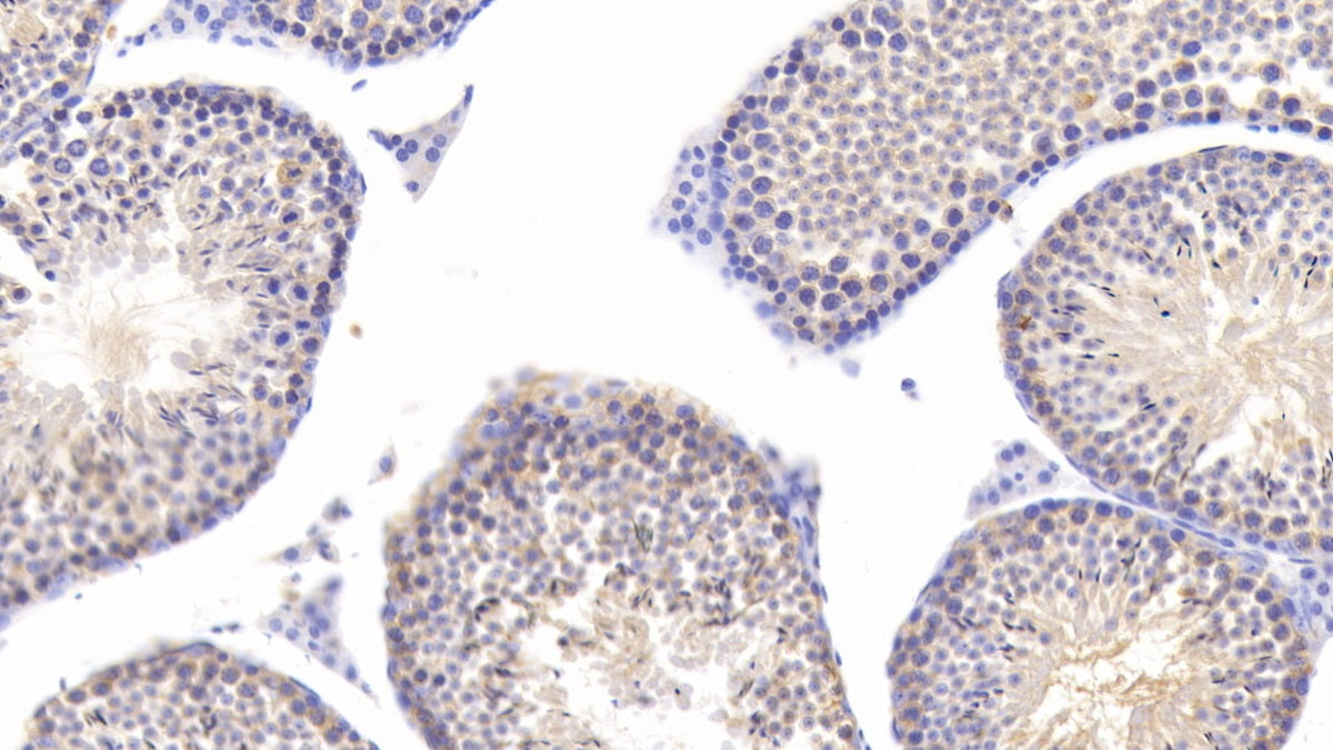 DAB staining on IHC-P; Sample: Mouse Cerebrum Tissue; Primary Ab: 20ug/ml Mouse Anti-Mouse HSPA5 Antibody; Second Ab: 2ug/mL HRP-Linked Caprine Anti-Mouse IgG Polyclonal Antibody