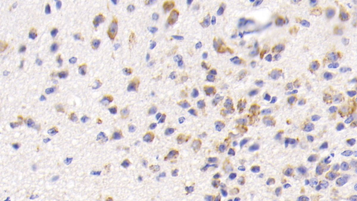 DAB staining on IHC-P; Sample: Mouse Cerebrum Tissue; Primary Ab: 20ug/ml Mouse Anti-Mouse HSPA5 Antibody; Control: Used PBS instead of primary antibody; Second Ab: 2ug/ml HRP-Linked Caprine Anti-Mouse IgG Polyclonal Antibody